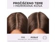 LOreal Paris Serum za teme koje se brzo masti Elseve Hyaluron pure