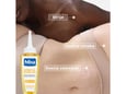 Mixa Ulje protiv strija 50ml