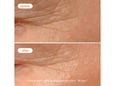 Novexpert Piling noćna krema 40ml